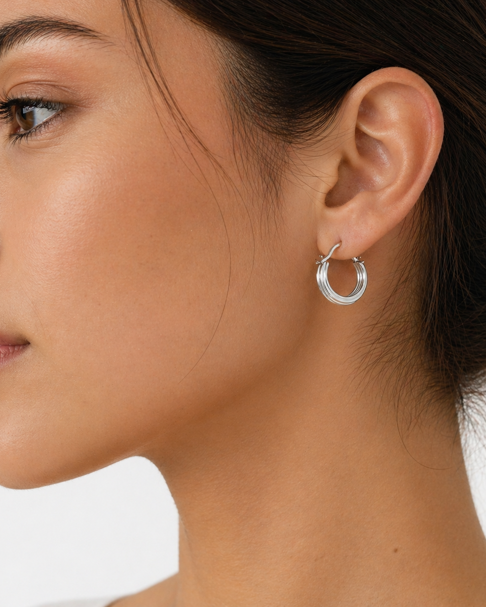 Aretes Orbita
